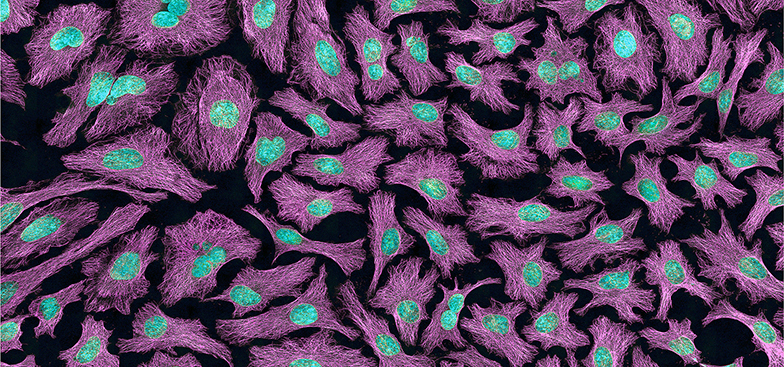 themicrotubules stained purple 